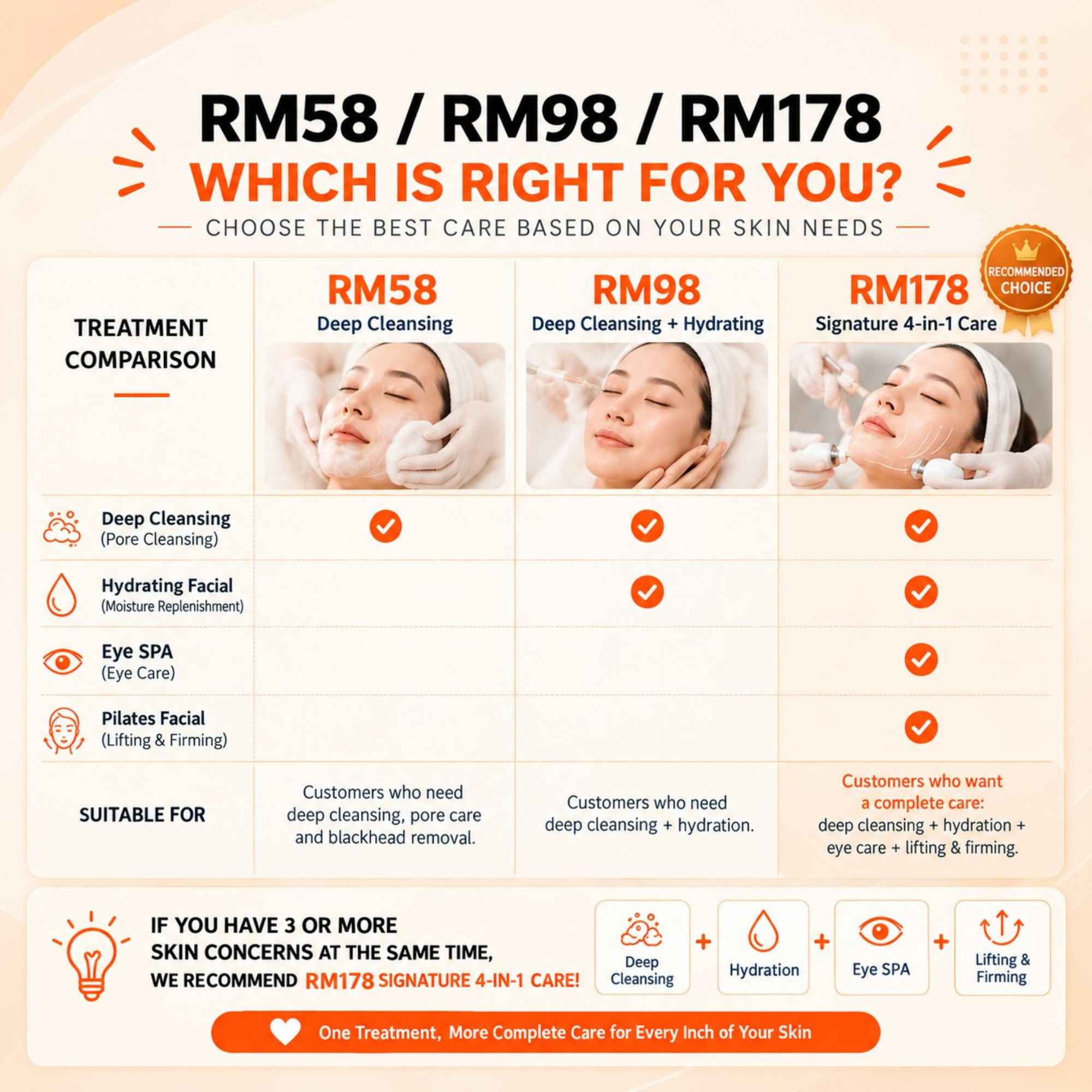 RM58 RM98 RM178 comparison